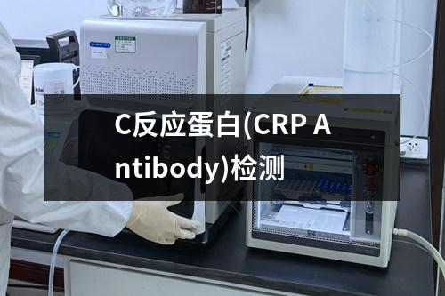 C反应蛋白(CRP Antibody)检测