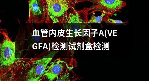 血管内皮生长因子A(VEGFA)检测试剂盒检测