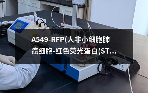 A549-RFP(人非小细胞肺癌细胞-红色荧光蛋白(STR鉴定正确))检测