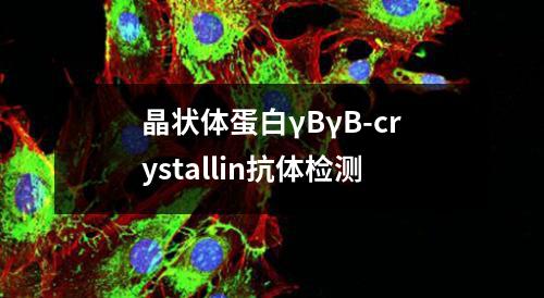 晶状体蛋白γBγB-crystallin抗体检测