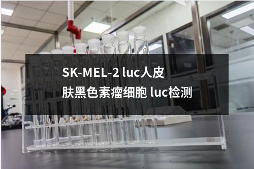 SK-MEL-2 luc人皮肤黑色素瘤细胞 luc检测