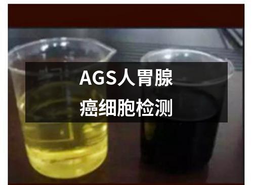 AGS人胃腺癌细胞检测