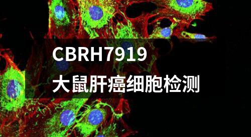 CBRH7919大鼠肝癌细胞检测