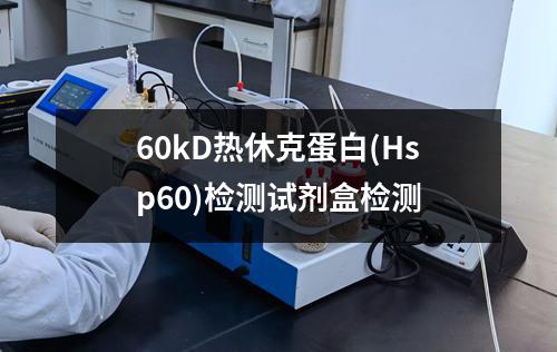 60kD热休克蛋白(Hsp60)检测试剂盒检测