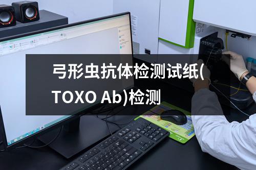 弓形虫抗体检测试纸(TOXO Ab)检测