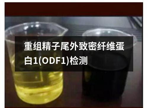 重组精子尾外致密纤维蛋白1(ODF1)检测