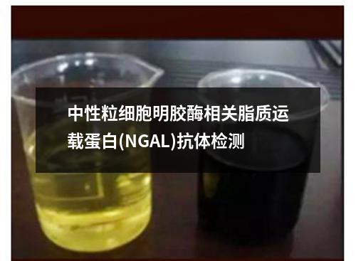 中性粒细胞明胶酶相关脂质运载蛋白(NGAL)抗体检测