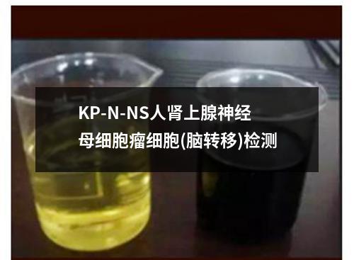 KP-N-NS人肾上腺神经母细胞瘤细胞(脑转移)检测