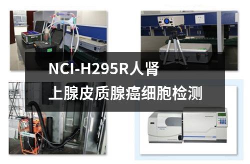 NCI-H295R人肾上腺皮质腺癌细胞检测