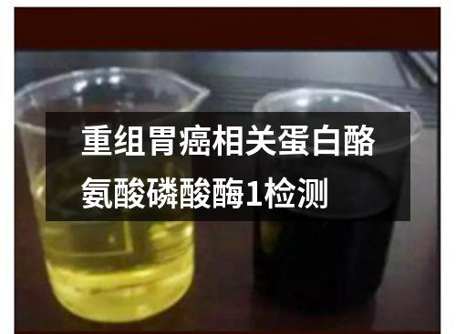 重组胃癌相关蛋白酪氨酸磷酸酶1检测