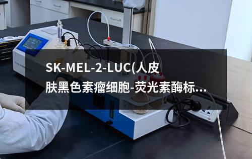 SK-MEL-2-LUC(人皮肤黑色素瘤细胞-荧光素酶标记(STR鉴定正确))检测